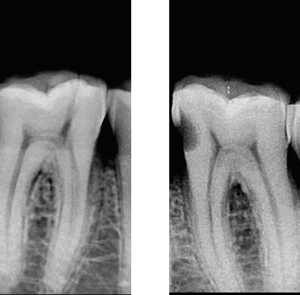 Molar